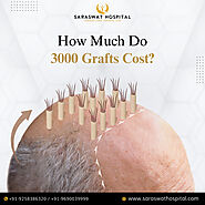 What is the Cost of Implanting 3000 Grafts in Hair Transplant?