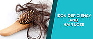 Iron Deficiency and Hair Loss Treatment