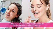 4 Reasons That Show Why The Demand Of Invisible Braces Increased Rapidly