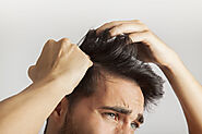 Which Is The Best Hair Loss Treatment Doctor In Delhi?