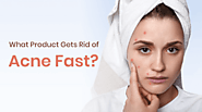 Top 10 Acne Control Products for Clear Skin of 2021