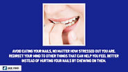 • Avoid eating your nails, no matter how stressed out you are. Redirect your mind to other things that can help you f...