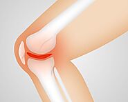 Home Remedies For Knee Pain In Hindi : घुटना दर्द के नुस्खें » Health In Hindi.net