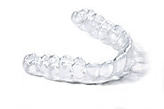 How to select a clear aligner brand?