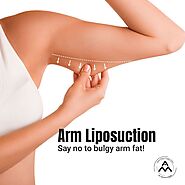 Liposuction Treatment In Delhi
