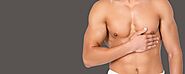 Male Breast Reduction in Delhi