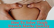 How To Solve Thigh Stretch Marks Quickly - DGS Health