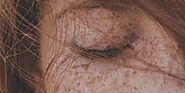 Are Moles Cancerous For You? - Trend Bytes