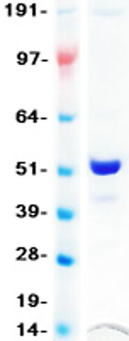 Recombinant Human GFAP protein