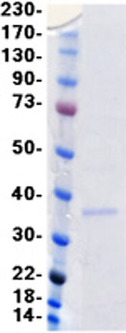 Recombinant Human CD20 / MS4A1 Protein