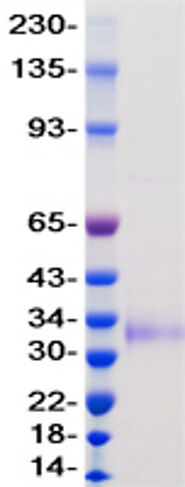 BEST Recombinant SARS-CoV-2 Spike S1 RBD protein, from EUPROTEIN