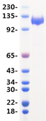 Superior SARS-CoV-2 Spike S1 Protein from EUPROTEIN