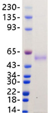 The BEST SARS-CoV-2 Nucleocapsid Protein, Expressed in Human Cell