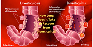 What is recovery time for diverticulitis surgery?