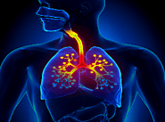 Journal of Lung, Pulmonary and Respiratory Case Reports - Clinical Images and Case Reports Journal