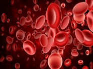 Journal of Hematology and Blood Case Reports - Clinical Images and Case Reports Journal