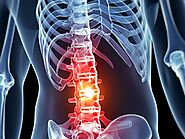 Stem Cell therapy in spinal cord injury - Stemcellindia