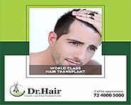 Know More About Follicular Unit Transplant from the hair specialist in jaipur