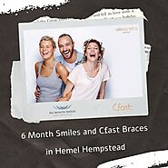 6 Month Smiles and Cfast Braces Hemel Hempstead