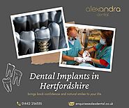Dental Implants Hertfordshire