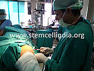 Stem cell therapy in Arthritis knee – stemcellindia