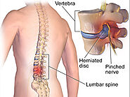 best ayurvedic treatment for back pain in kerala
