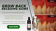 Can Your Gums Grow?