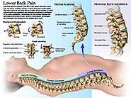 Best Stem cell therapy for spinal cord injury