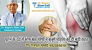 Stem Cell Therapy for Arthritis knee in Delhi