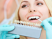 Teeth Whitening | Admire Dentistry