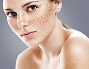 Skin Pigmentation Treatment Vadodara