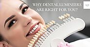 Why Dental Lumineers Are Right For You?