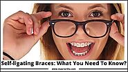 Self-ligating Braces: What You Need To Know? : masriortho — LiveJournal