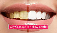 Say Goodbye To Yellow Teeth: Get a Pearly White Smile!