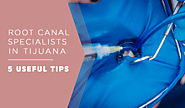 Root Canal in Tijuana: 5 Useful Tips You Need to Know