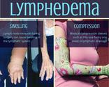 Lymphedema