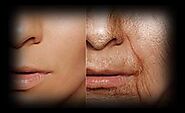 Anti-Ageing Treatments| Wrinkles, Fine lines, Saggy Skin| Inurskn