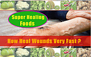 How To Heal Wounds Faster With Your Diet | Best Foods To Heal Wounds