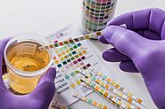 How do urine sample drug tests work?