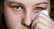 Conjunctivitis | Causes or Etiology | Symptoms | Prevention | Medication and Treatment - Times of News 24x7