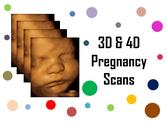 3D and 4D Pregnancy Scans
