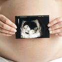 How Soon Can You Have a 3D Ultrasound? | eHow