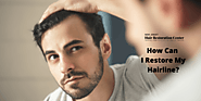 Hair Restoration: How Can I Restore My Hairline? NJHRC Blog