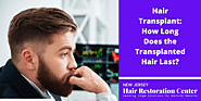 Hair Transplant: How Long Does the Transplanted Hair Last? NJHRC Blog
