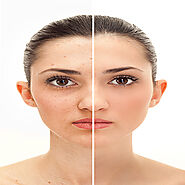 Skin Care | Anti-Aging | Plastic Surgery Tip