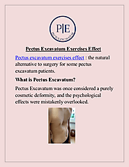 Pectus Excavatum Exercises Effect | edocr