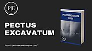 Information About Pectus Excavatum - Pectus Excavatum Guide by Pectus Excavatum Guide - Issuu