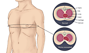 All Things Which You Know About Pectus Excavatum