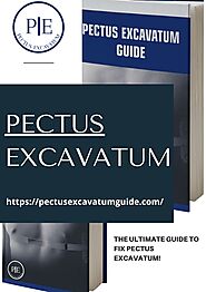 Pectus Excavatum Guide — Pectus Excavatum Guide Program - Pectus Excavatum...