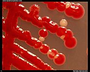 Serratia marcescens' red colonies